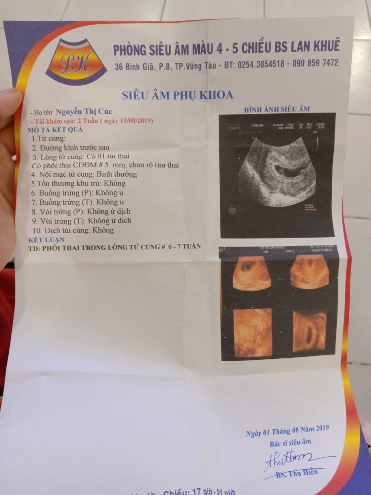 Làm Giấy Khám Thai Giả Phôi Thật Không Cần Đến Bệnh Viện