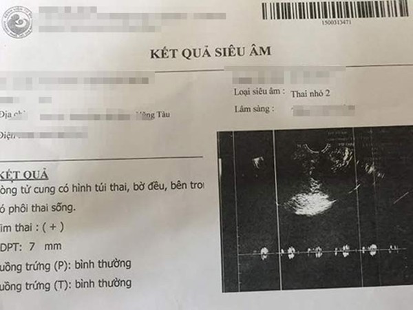 Làm Giấy Khám Thai Giả - Làm Giấy Siêu Âm Giả Theo Yêu Cầu